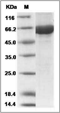 Human Cbl-c / CBL-3 Protein (His & GST Tag) SDS-PAGE