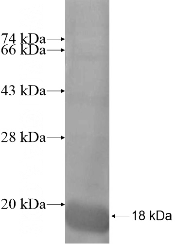 Recombinant Human XAGE2B SDS-PAGE