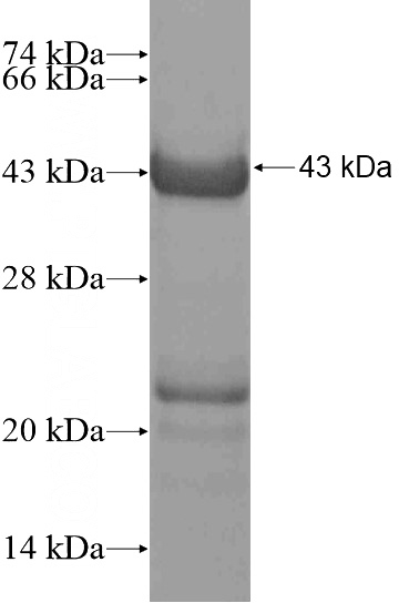Recombinant Human BEND3 SDS-PAGE