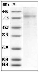 Human PLTP Protein (His Tag) SDS-PAGE
