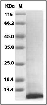 Human I-309 / CCL1 / TCA-3 Protein SDS-PAGE