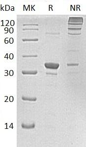 Human SULT1A2/STP2 (His tag) recombinant protein