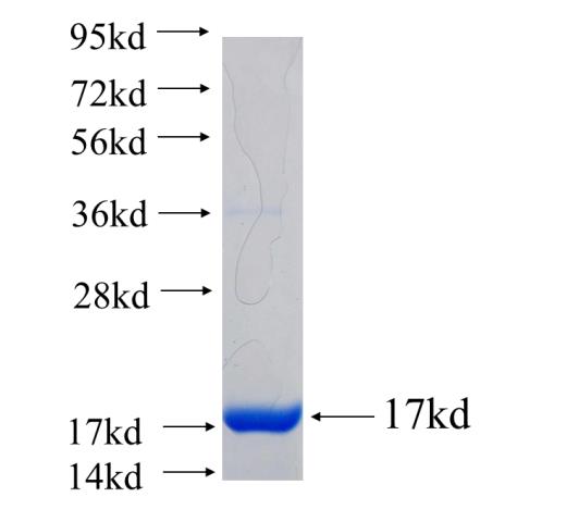Recombinant human EZH2 SDS-PAGE