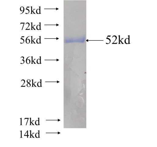 Recombinant human DUSP15(Full length) SDS-PAGE