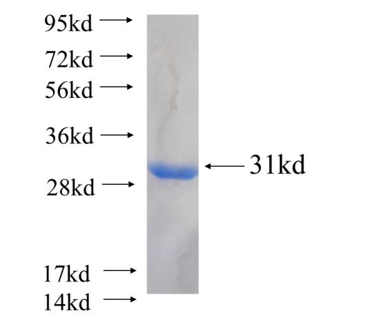 Recombinant human PCMT1(Full length) SDS-PAGE