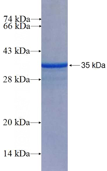 Recombinant Human C1orf77 SDS-PAGE