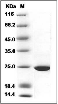 Human GSTK1 Protein SDS-PAGE