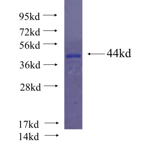 Recombinant human LRRC42 SDS-PAGE