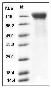Mouse IL12RB2 / IL12R-beta 2 Protein (His Tag) SDS-PAGE