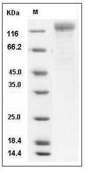 Human coronavirus spike glycoprotein Protein (aa 1-760, His Tag) SDS-PAGE