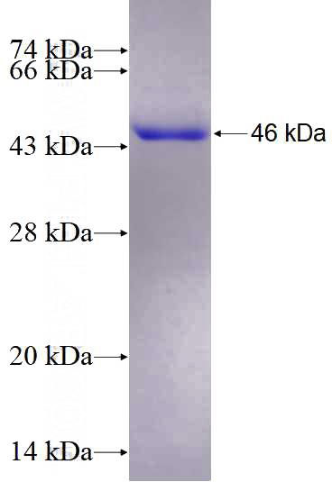 Recombinant Human ABCG8 SDS-PAGE