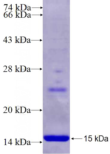 Recombinant Human PRPF31 SDS-PAGE