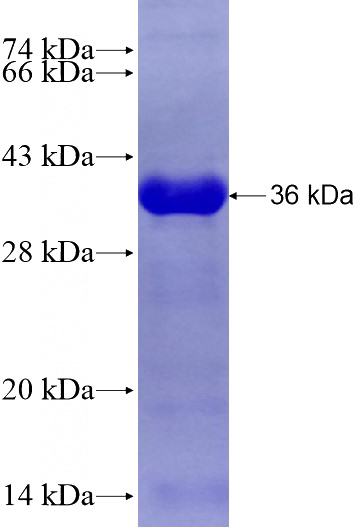 Recombinant Human ZC3H14 SDS-PAGE