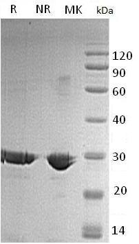 Human TPI1/TPI (His tag) recombinant protein