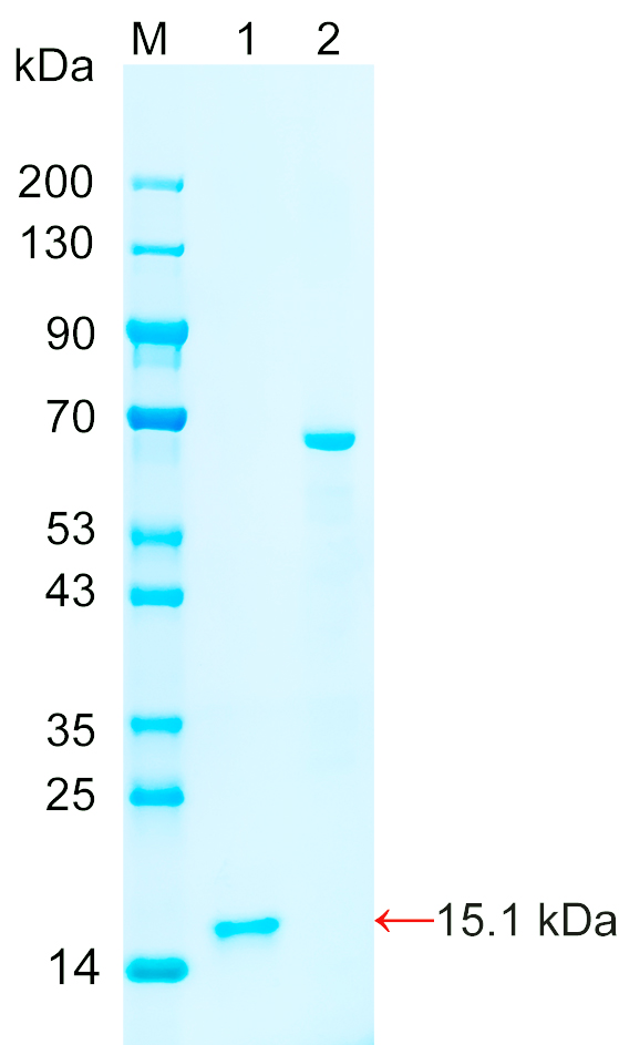 Recombinant KLRG2 protein (His tag) SDS-PAGE