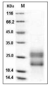 Human RSPO3 / R-spondin 3 Protein (aa 1-146, His Tag) SDS-PAGE