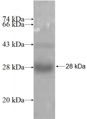 Recombinant Human CBARA1 SDS-PAGE