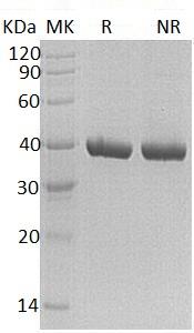 Human CA11/CARP2/UNQ211/PRO237 (His tag) recombinant protein