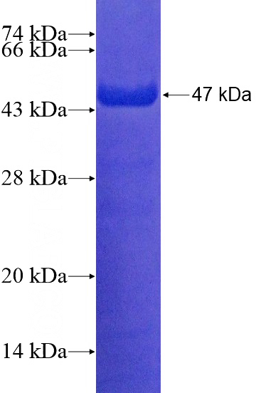Recombinant Human PCDH20 SDS-PAGE