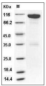 Mouse EphA6 / EHK-2 Protein (Fc Tag) SDS-PAGE
