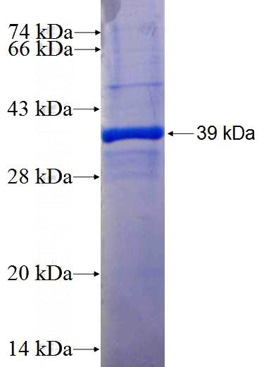 Recombinant Human PRPF31 SDS-PAGE