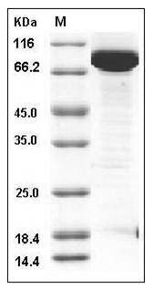 Human EED / Embryonic Ectoderm Development Protein (His & GST Tag) SDS-PAGE