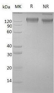 Human OSMR/OSMRB (His tag) recombinant protein