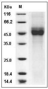 Human CD19 / Leu-12 Protein (His Tag) SDS-PAGE