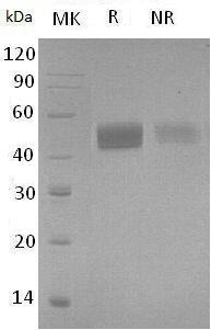 Human MSLN/MPF (His tag) recombinant protein