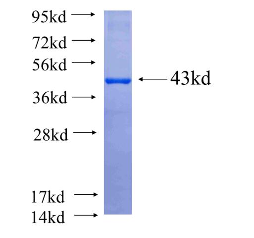 Recombinant human DNAJC3 SDS-PAGE