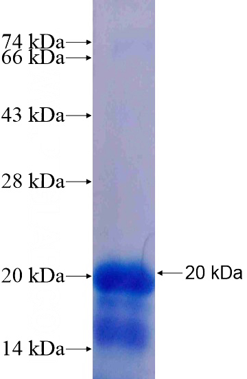 Recombinant Human ONECUT1 SDS-PAGE