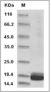 Human IL1F5 / IL36RN Protein SDS-PAGE