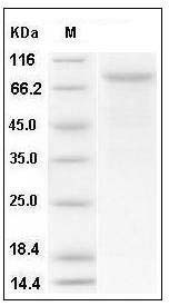 Mouse VE-Cadherin / CD144 / CDH5 Protein (His Tag) SDS-PAGE