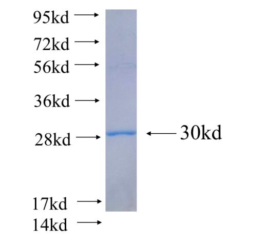 Recombinant Arabidopsis thaliana ATSOS3 SDS-PAGE
