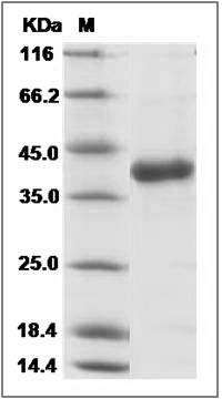 Influenza A H7N9 (A/Pigeon/Shanghai/S1069/2013) Hemagglutinin Protein (HA1 Subunit) (His Tag) SDS-PAGE
