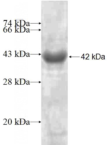 Recombinant Human EZH2 SDS-PAGE