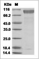 Ebola virus EBOV (subtype Sudan, strain Gulu) GP1 / Glycoprotein Protein (His Tag)
