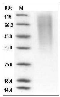 Human CD164 / Endolyn Protein (His Tag) SDS-PAGE