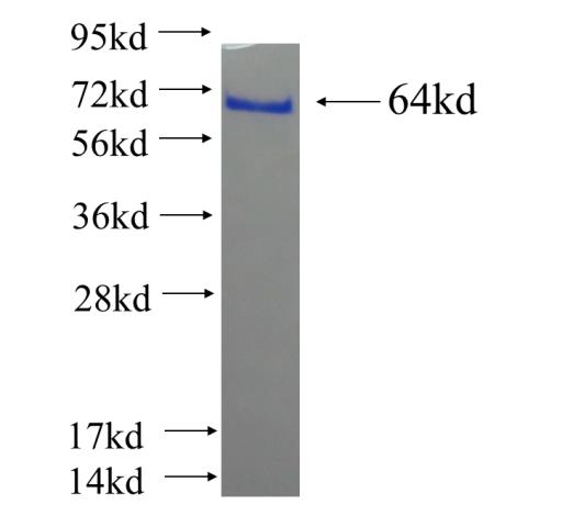 Recombinant human TACC3 SDS-PAGE