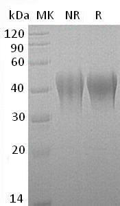 Mouse Tnfrsf1b (His tag) recombinant protein