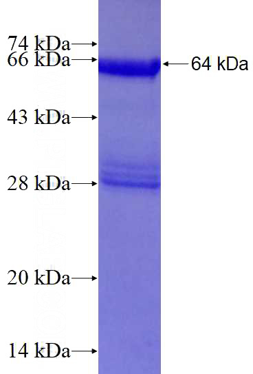 Recombinant Human ROD1 SDS-PAGE