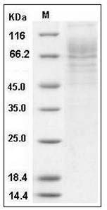Human Thrombopoietin / THPO / TPO Protein (His Tag) SDS-PAGE