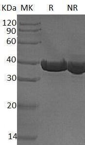 Human ALDOA/ALDA (His tag) recombinant protein