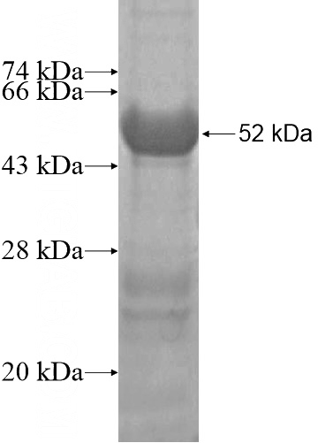 Recombinant Human C17orf39 SDS-PAGE
