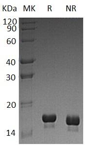 Human CST3 (His tag) recombinant protein