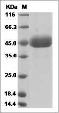 Influenza A H5N8 (A/turkey/Ireland/1378/1983) Hemagglutinin / HA Protein (His Tag) SDS-PAGE