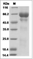 Rat PSAP / Prosaposin Protein (His Tag)