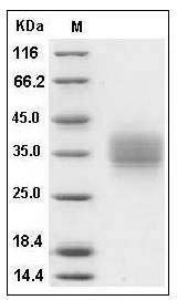 Mouse Frizzled-1 / FZD1 Protein (His Tag) SDS-PAGE