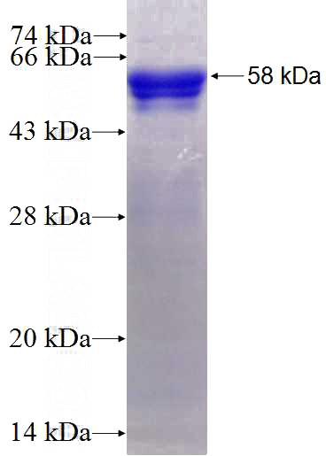 Recombinant Human SIX1 SDS-PAGE