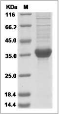 Human GHRH Protein (Fc Tag) SDS-PAGE